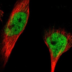 RBM33 Antibody, Novus Biologicals 0.1mL; Unlabeled:Antibodies, Polyclonal